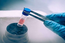 Lazo de Vida se dedica a la criopreservación de células madre con fines de transplante / Bigstock